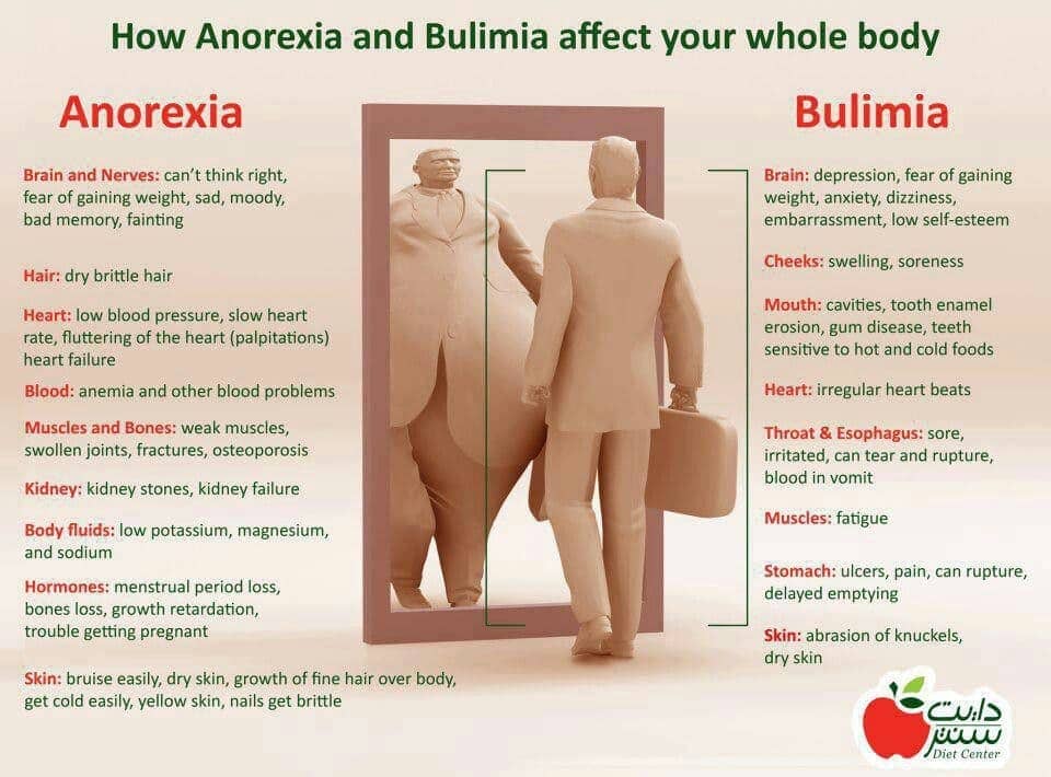 Image result for anorexia bulimia