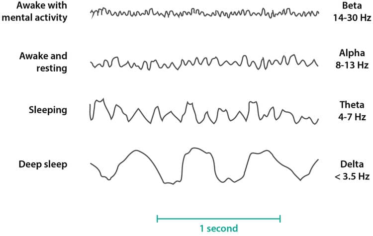 Image result for eeg alpha wave