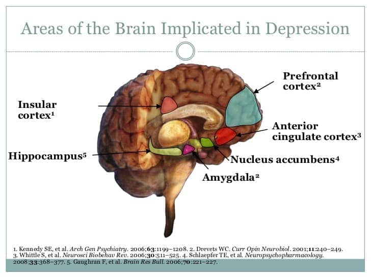 Image result for amygdala and prefrontal cortex depression